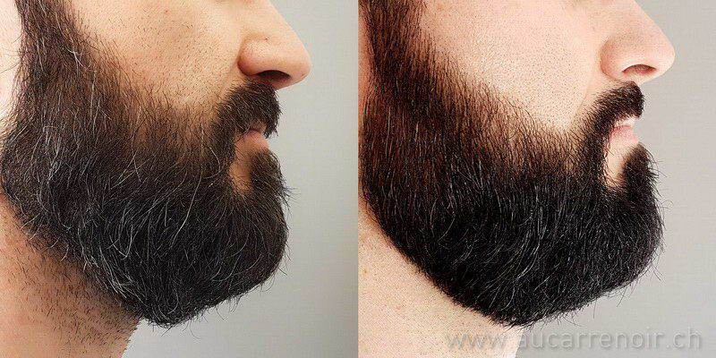 Photo d'une coloration de barbe avant et après